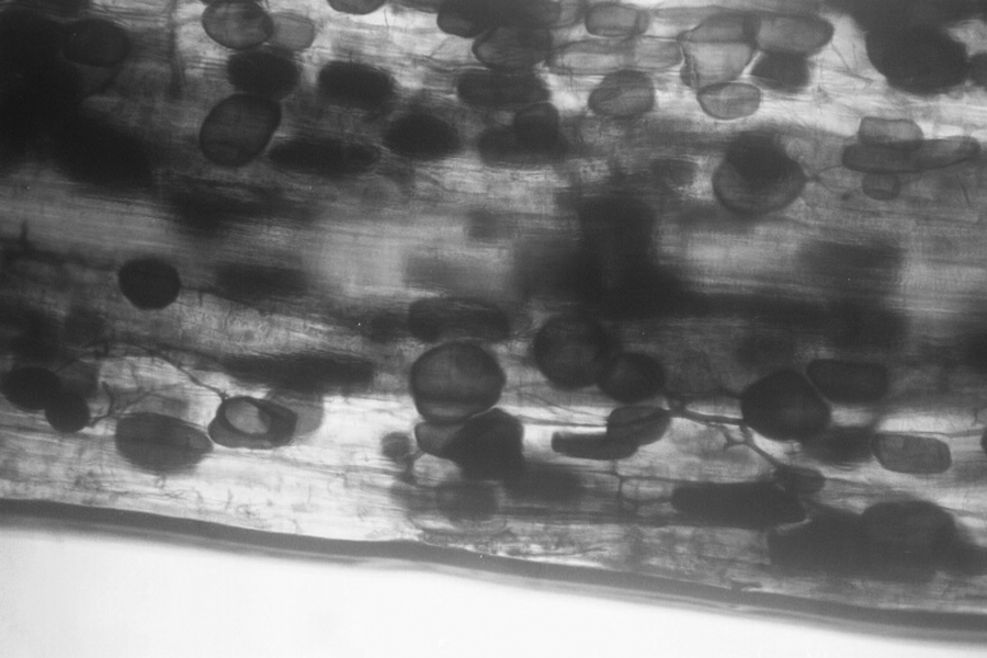 Vesicles in roots of Liquidambar styraciflua.